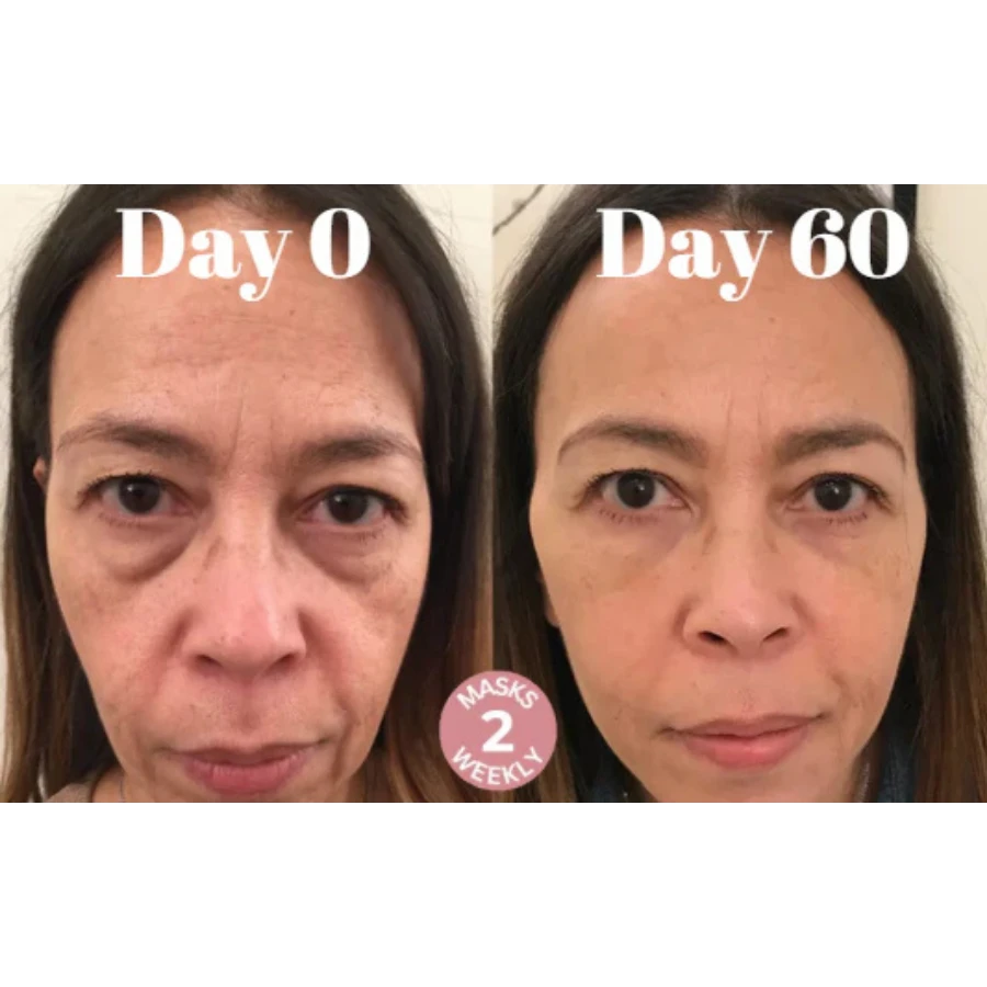 Microcrystalline Laugh Line Lifting Masks