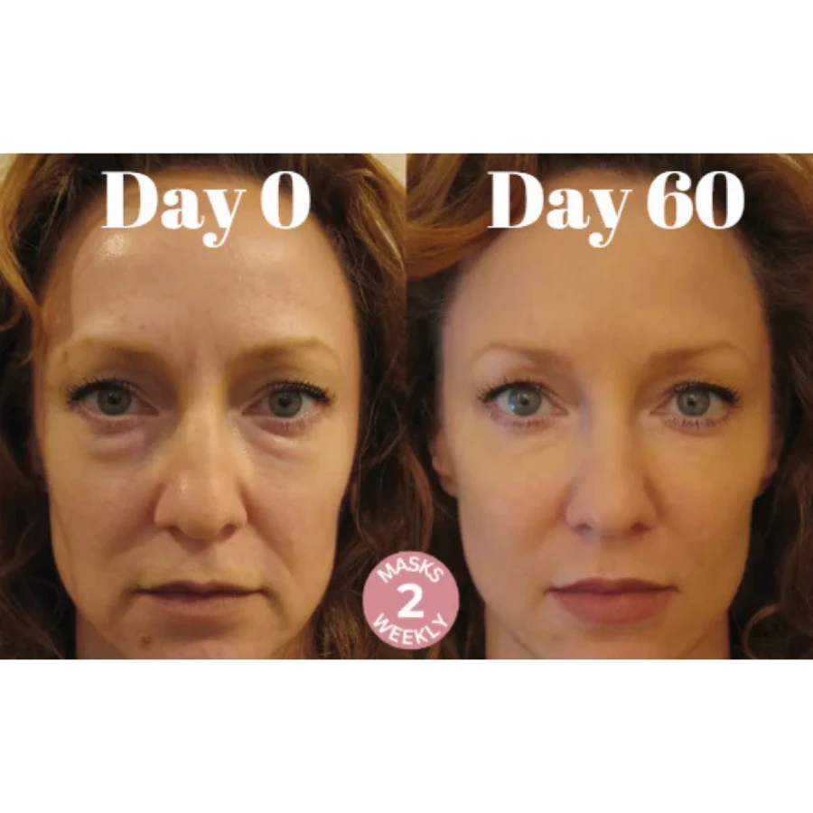 Microcrystalline Laugh Line Lifting Masks