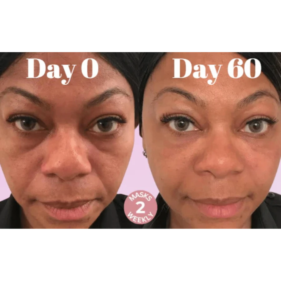 Microcrystalline Laugh Line Lifting Masks