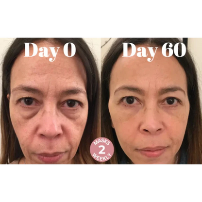 Microcrystalline Laugh Line Lifting Masks