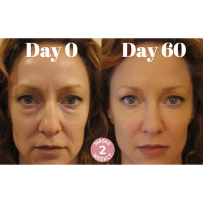 Microcrystalline Laugh Line Lifting Masks
