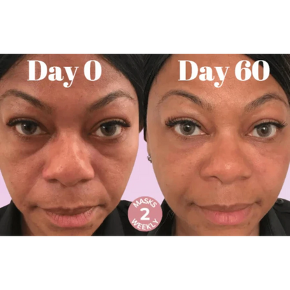 Microcrystalline Laugh Line Lifting Masks